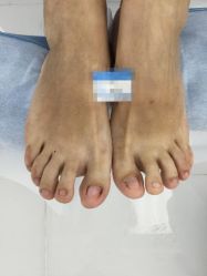 点击看大图 -派恩宜灰指甲鸡眼嵌甲手足癣