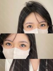 -倩极·精研痘敏肌管理