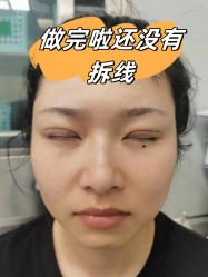 -素美医疗美容·西南眼鼻整形·修复基地