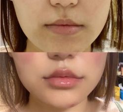 点击看大图 -深圳美莱医疗美容医院