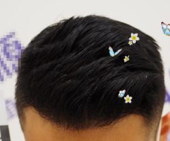 -大麦微针植发全国连锁