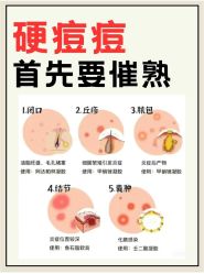 -悟空祛痘·诺奖技术专业店