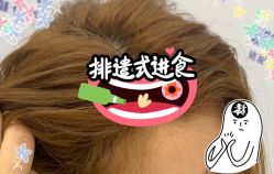 -大麦微针植发全国连锁