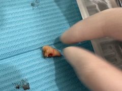 -泰康拜博口腔(华发门诊)