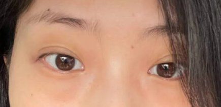 -紫洁俪方（北京）医疗美容