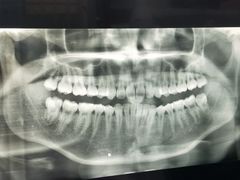 -土豆口腔(凤凰北总店)