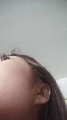 -宜肤清颜专业祛痘问题肌修护
