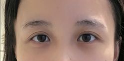 -Doris多里斯半永久纹眉·SMP纹发·发际线