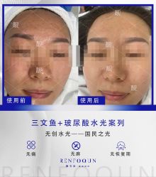 点击看大图 -靓芙泉·0感专研祛痘