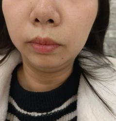 -清颜堂丨分子祛痘·功效美肤