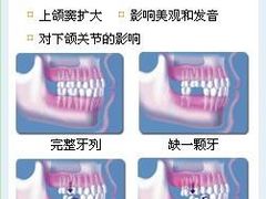 -团圆口腔·种植中心(锦江院区)