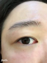 -伊丽莎白医疗美容