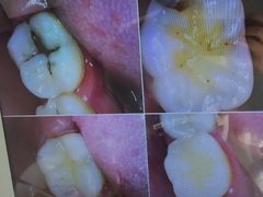 -同步齿科·数字化正畸种植口腔中心(珠海店)