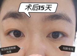 -Yestar艺星整形