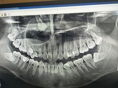 -同步齿科·数字化正畸种植口腔中心(珠海店)