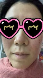 体验后-JS医疗美容