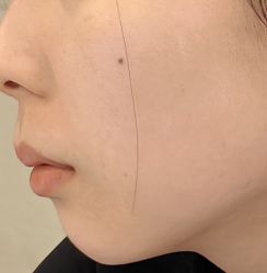 -长沙雅美医疗美容医院