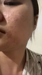 体验后-上海宏康医院·医疗美容科