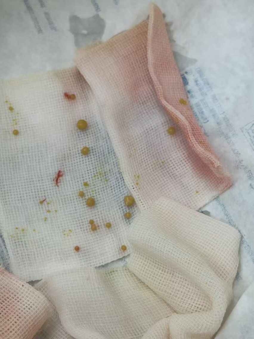 公犬膀胱结石,是一种非常常见的疾病,它会给狗狗带来很大的痛苦,并