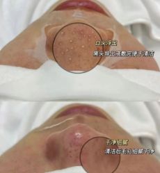 -Cream88颜皮肤管理中心