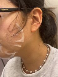 点击看大图 体验后-BR光电保养