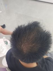 -北京雍禾植发医院