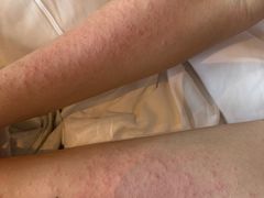 -复旦大学附属华山医院(总院)