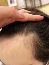 -熙朵美学植发连锁