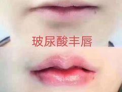 -友阿国际广场(邵阳店)