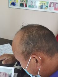 -唐风采假发补发定制