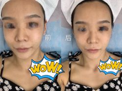 -小忠丽格医美