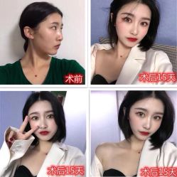 -南宁华美医疗美容医院