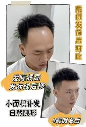 -唐风采假发补发定制