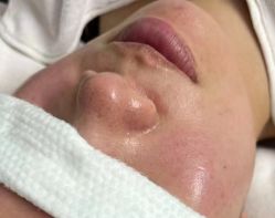 -杭州米兰柏羽医疗美容医院