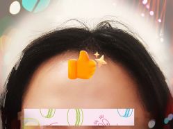 -大麦微针植发全国连锁