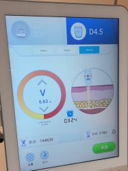 体验后-BR光电保养