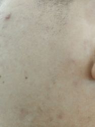 -蕾特恩专业祛痘·皮肤管理