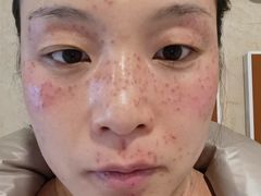 -杭州市第三人民医院