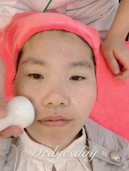 -成都苗方清颜专业祛痘