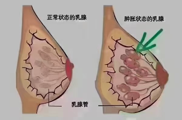 内乳淋巴结位置图片