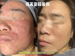 -元熙兰积皮肤管理