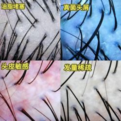 -Bollins波林丝•专研护发中心