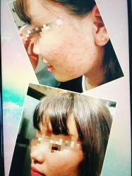 -康美贞·痘肌养护管理中心