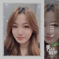 -大麦微针植发全国连锁