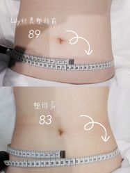 点击看大图 -Lily纤美·科技减脂中心