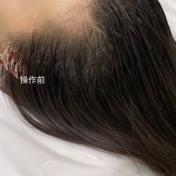 -MISS STAR·半永久纹眉·发际线·美瞳线