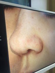-苑苑vbeauty科技美容SPA
