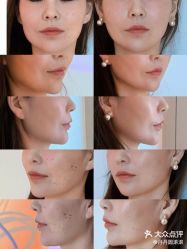 -海菲秀·飞顿牛奶光·LDM官方授权中心美轮美浣瓷感美肌