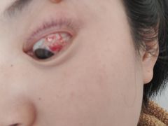 -上海大学附属上海和平眼科医院