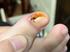 -新甲连锁灰指甲·甲沟炎·鸡眼(黑龙江路店)